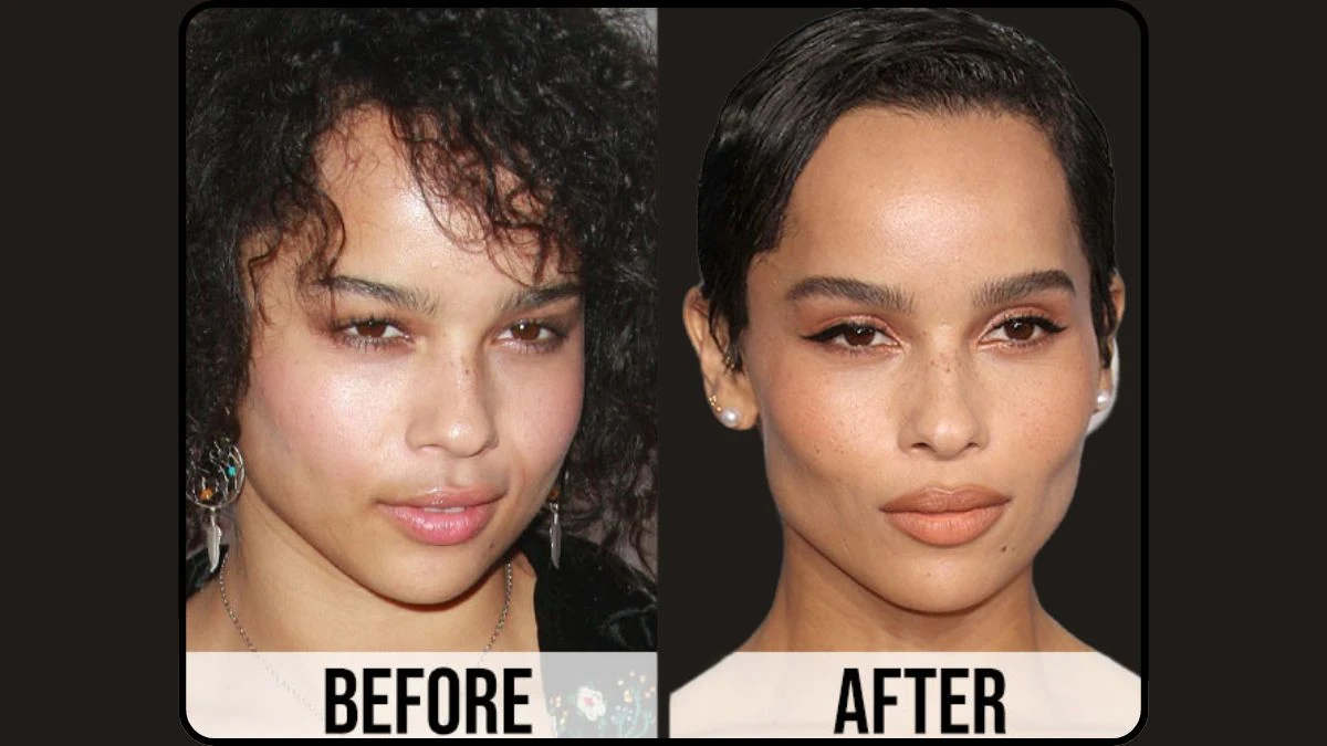Did Zoe Kravitz Get Plastic Surgery? Zoe Kravitz Before and After Plastic Surgery and More