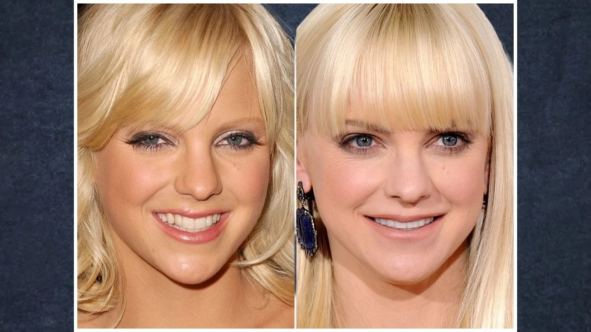 Anna Faris Plastic Surgery, Who is Anna Faris?