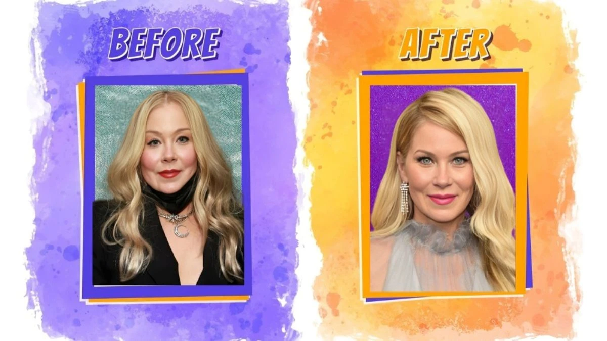 Christina Applegate Plastic Surgery - Everything You Need to Know